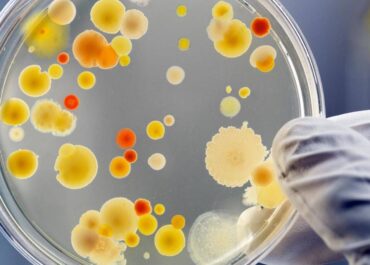 Специалисты микробиологического отдела ФГБУ «Хабаровский референтный центр Россельхознадзора» исследовали 933 пробы пищевой продукции на бактерии Staphylococcus aureus